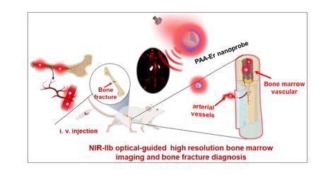 In Vivo High Resolution Bioimaging Of Bone Marrow And Fracture