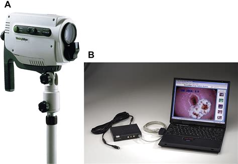 Performance Of A Colposcopic Examination A Loop Electrosurgical