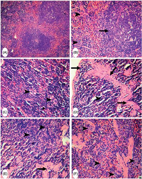 Representative Photomicrographs Of H E Stained Spleen Sections A