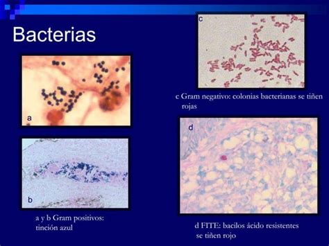 Tinciones Histologicas Autoguardado Ppt