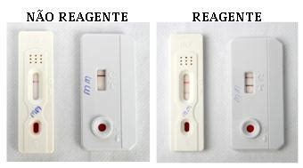 Teste R Pido Pode Detectar Hiv Em Apenas Minutos Not Cia Una Sus