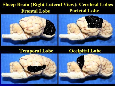 Comparing The Sheep Brain To The Human Brain