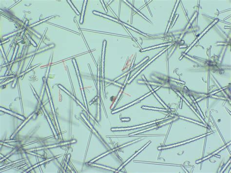 Measurement of sponge spicules - Image Analysis - Image.sc Forum