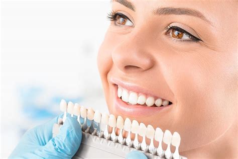 Dental Veneers: What to Expect During Your Veneers Procedure - Silver ...