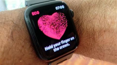 The Benefits of Using a Smartwatch with ECG - Superwatches