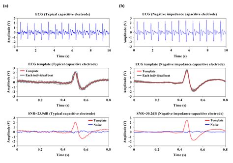 Continuous ECG Measurement ECG Template And SNR Analysis From A A