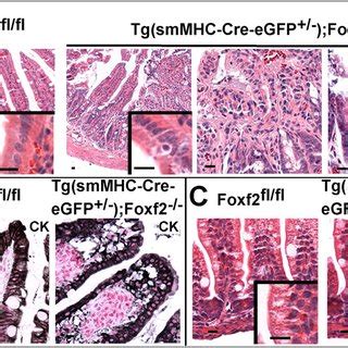 Decreased Foxf And Length Of Intestinal Tract In Tg Smmhc Cre Egfp