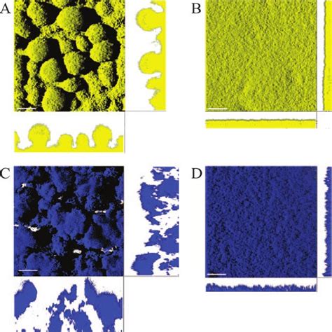 Confocal Laser Scanning Micrographs Of Day Old Biofilms Formed By P