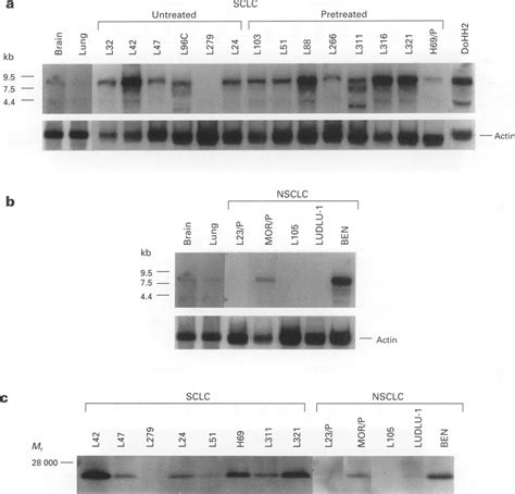 C Shows Bcl 2 Protein Expression In SCLC And NSCLC Cell Lines With