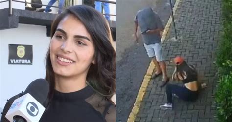 Jovem atacada soda cáustica aparece em primeira entrevista e fala