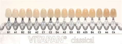 Tooth Color Chart Shade Guide