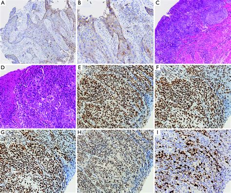 IHC Staining Of The Specimens A Positivity Of IHC Staining In The