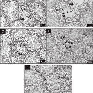 Histological Sections Of Testes Of Normal And ZZREE Treated HFD Induced