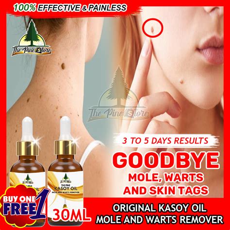 Kasoy Oil 100 Effective Buy 1 Take 1 Mole Remover Wart Remover 30ML