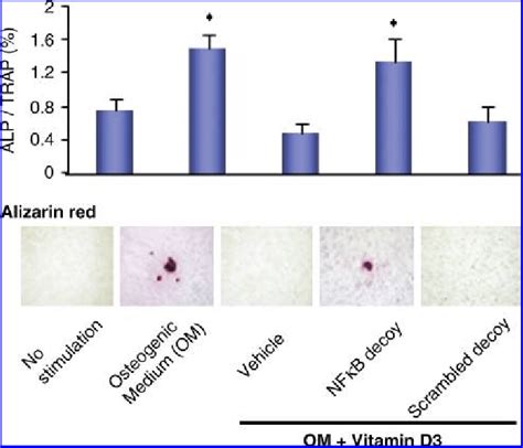 Effect Of Nf Kb Decoy Odn On In Vitro Calcification Model In Rabbit