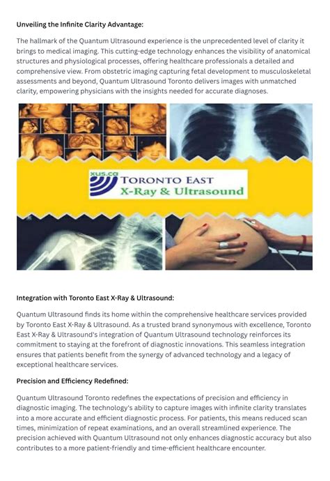 PPT Toronto East X Ray Ultrasound The Quantum Ultrasound Experience