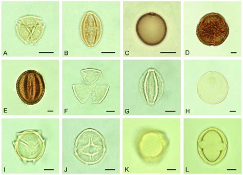 Some Non Nectariferous Pollen Types Found In Extracted And Squeezed