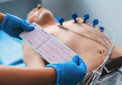 Electrocardiogram Ekg Heart Experts Of Florida