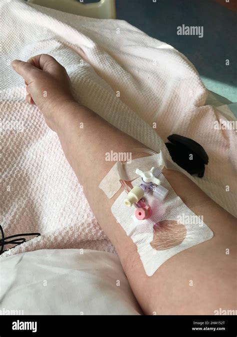 Intravenous Drip Intensive Care Hi Res Stock Photography And Images Alamy