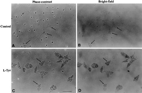 Melanoblasts And Melanocytes Derived From Epidermal Cell Suspensions Of