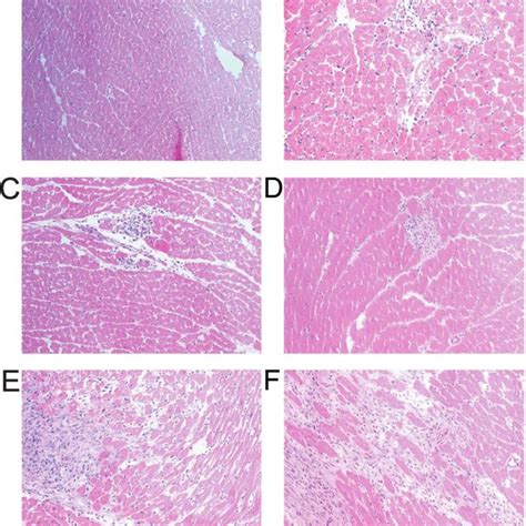 Hematoxylin Eosin Staining Of Cardiac Tissue Sections From Control A