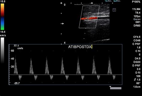 Ecodoppler Arterioso Arti Inferiori Studio Medico San Carlo Dr