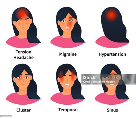 Vetores De Ilustrações Mostrando Tipos De Dores De Cabeça E Mais Imagens De Dor De Cabeça Dor