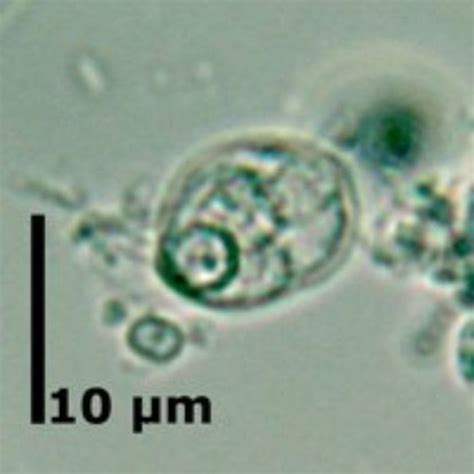 Chilomastix Mesnili Parasite Diagnosis