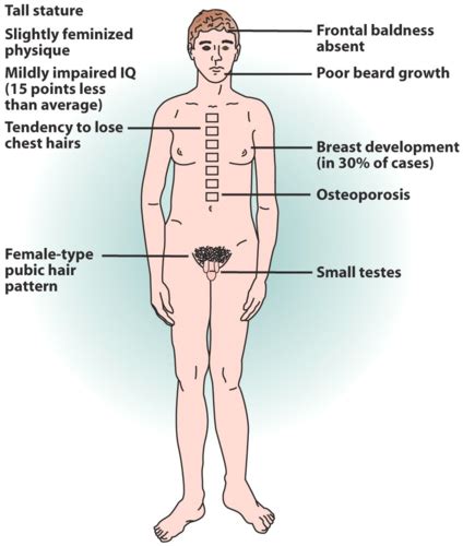 Peds Endocrine Flashcards Quizlet