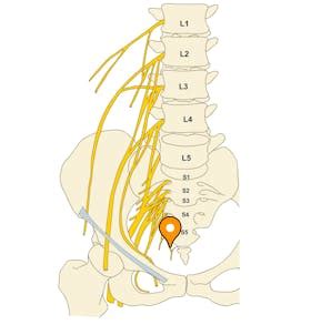 Coccygeal nerve - e-Anatomy - IMAIOS