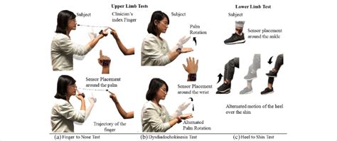 Cerebellar Examination