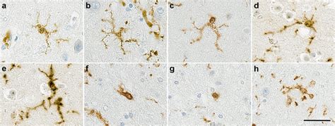 Illustration Of Different Microglial Morphologies In Human Brain Download Scientific Diagram