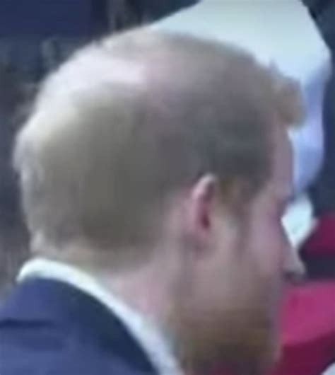 Is Prince Harry Going Bald Princes Scalp Visible As He Steps Out With