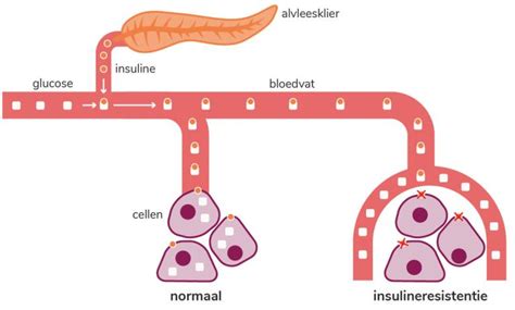 Hoe Zijn De Bloedglucosewaarden Bij Diabetes Type 2 Diabetes Nl