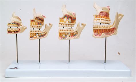 3B Scientific® Dentition Development Model | Flinn Scientific