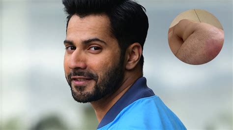 No Pain No Gain Varun Dhawan Sustains Injury On First Day Of Atlee S