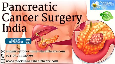 Plan Your Pancreatic Cancer Treatment In India Forerunner Healthcare