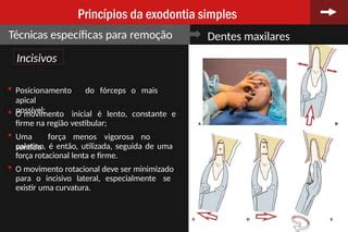Exodontias O Que É - aula exodontias versão anterior e final para aulanal | PPTX