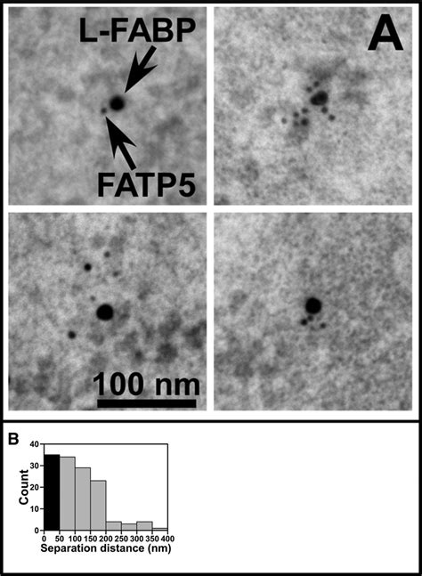 Double Immunogold Labeling Of Fatp And L Fabp At The Plasma Membrane