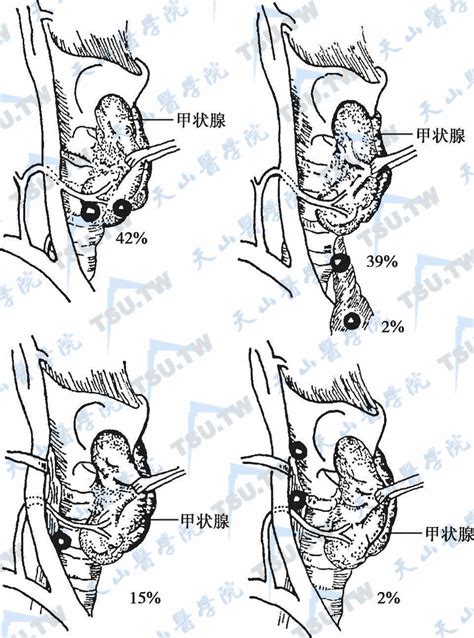 从解剖学认识甲状旁腺的位置分布情况 哔哩哔哩