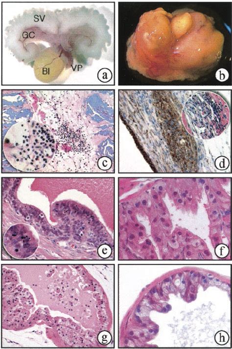 Histopathology Of Sra Expression In The Male Accessory Sex Glands