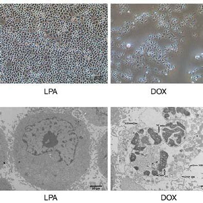 Morphology Of Hela Cells Treated With Dox And Lpa A Images Were