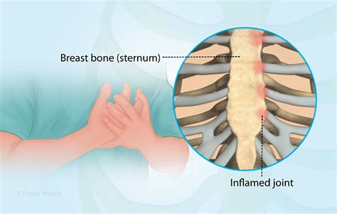 Health Condition : Symptoms, Causes, Treatment and More