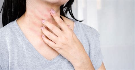 Top 9 Ways To Prevent Neck Skin Itching You Should Know Doctor Network