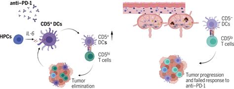 Cancer patients who don't respond to immunotherapy may lack crucial immune cells