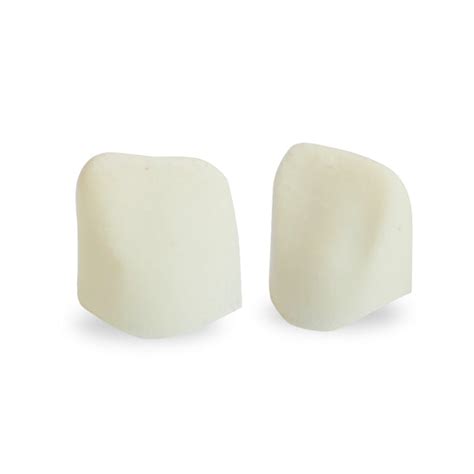 Diana Dental Crowns Our Primary Upper Lateral Incisor Figaro Crowns