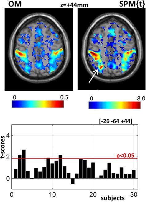 Illustrates a strong effect in the parietal lobule from the standard ...