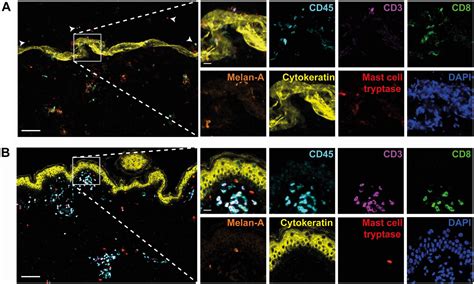 Improvement Of Opal Multiplex Immunofluorescence Workflow For Human