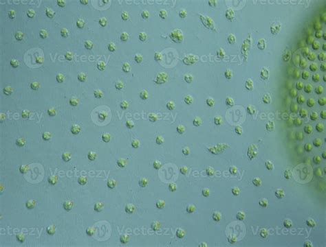 Green algae in drops of water under the microscope 100x 12971051 Stock ...