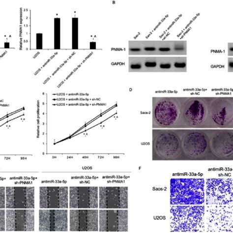 Jpx Knockdown Inhibited Saos 2 And U2os Cell Proliferation Migration